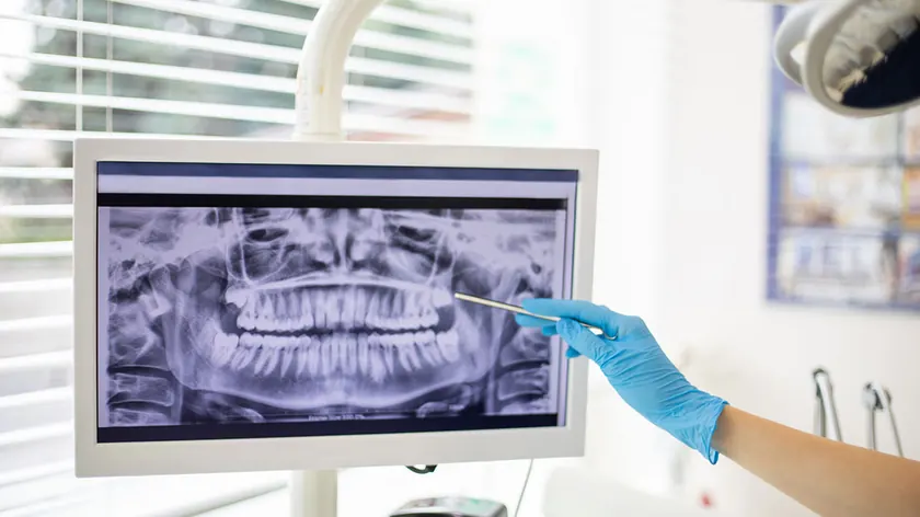 A digital radiograph on screen being reviewed with a patient.