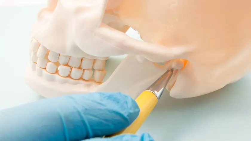 A model of the temporomandibular joint used to explain TMJ disorders.